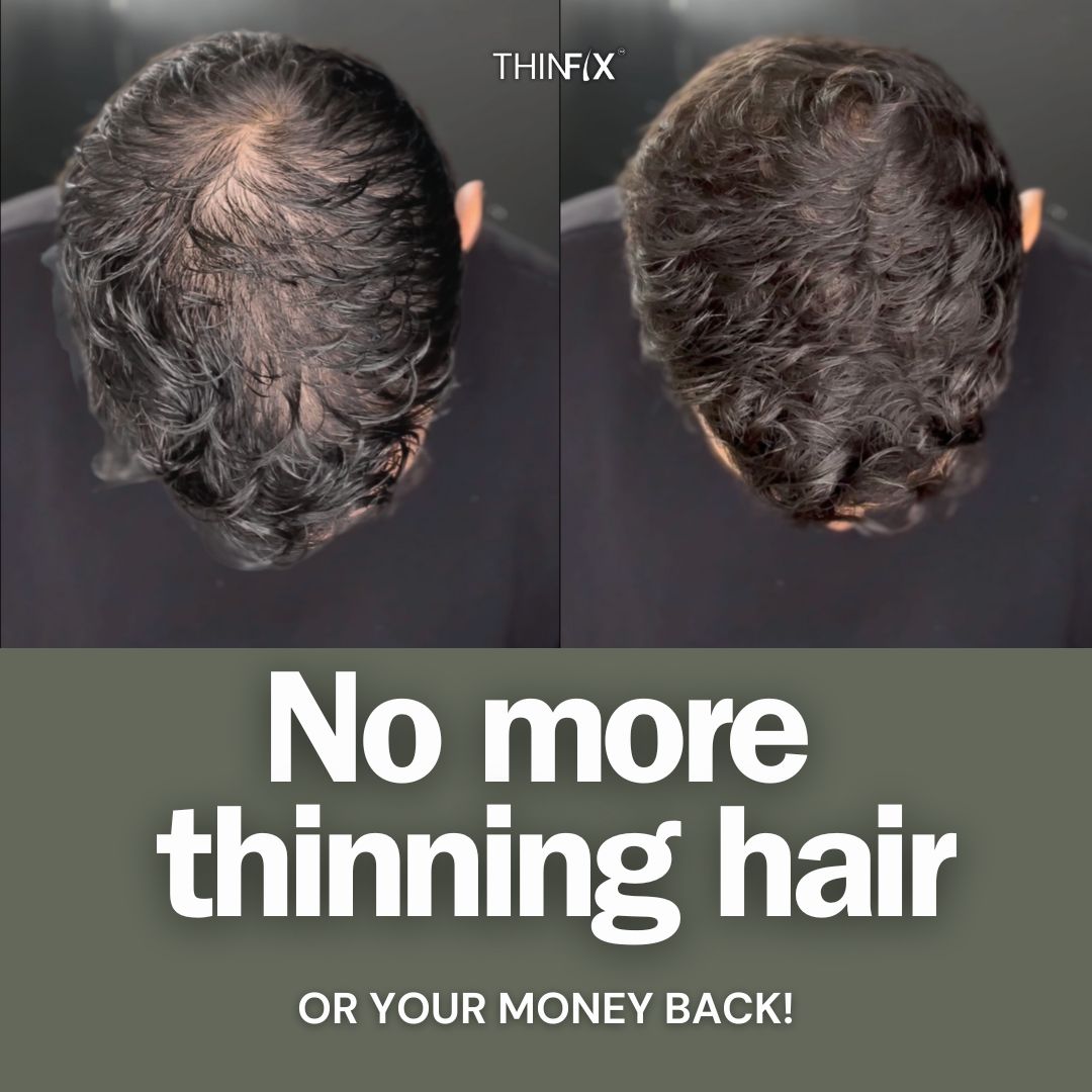 THINFIX™ Hair Growth Routine